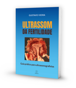 Ultrassom da Fertilidade - mockup da capa