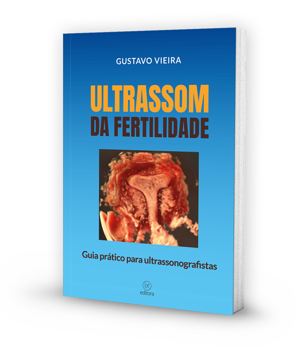 Ultrassom da Fertilidade - mockup da capa